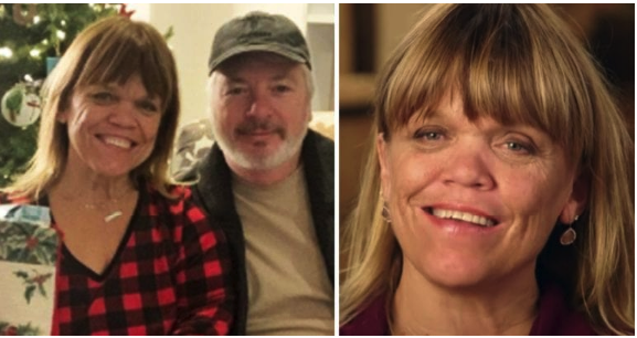 Her legs are amputated after using a common household product – Now she’s warning women everywhere