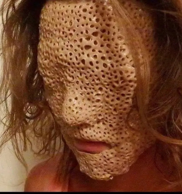 Trypophobia: 15 Pics That Will Make You Cry in Fear