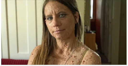 Overcoming Challenges: Libby’s Inspiring Journey 