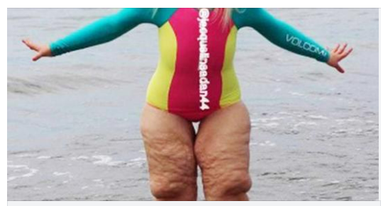 Bullies mock her “disgusting” legs – then she takes a close-up and silences them