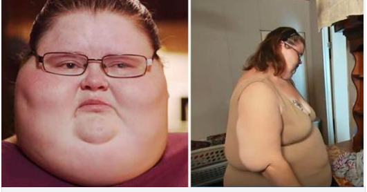 This is what Ashley Bratcher from ”My 600-Lb Life” looks like today