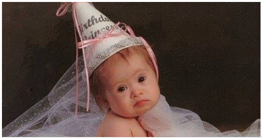 They advised the mother to give up her Down syndrome kid, but she refused to do so… Here is how she looks today as a model!