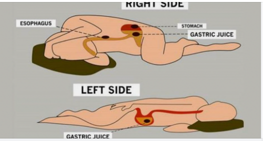 Unlock the Unexpected Benefits of Sleeping on Your Left Side! 