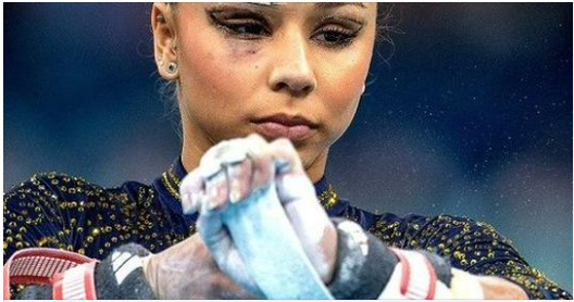 Why Did Flavia Saraiva Compete at the Olympics with a Bandaged Face – Top 3 Gymnast Injuries This Year 