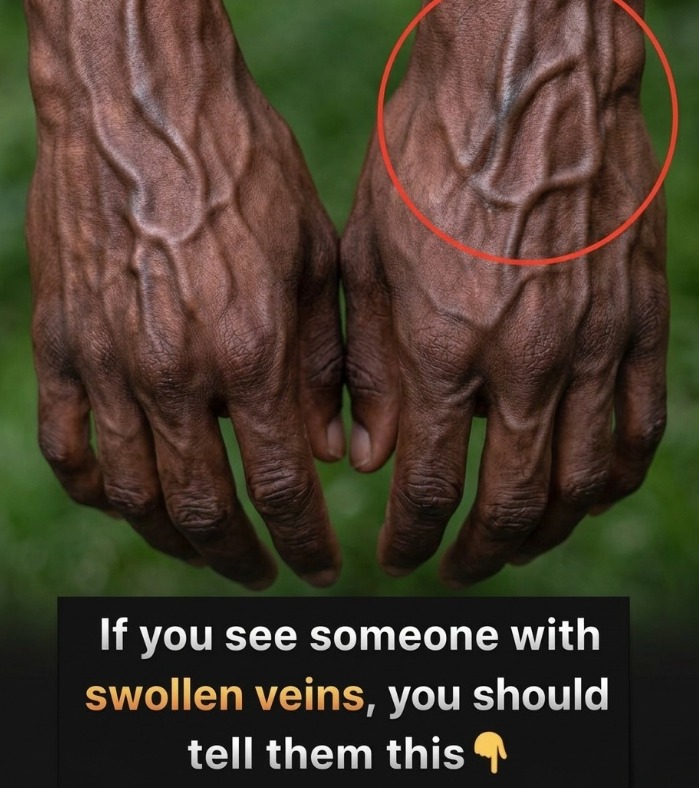 “The Hidden Clues in Your Hands: What the Veins Might Reveal About Your Heart Health, Leaving Experts and Everyday People Questioning What Signs Are Subtle, What Risks Lurk Unnoticed, and How Something as Simple as Looking at Your Own Hands Could Hold Secrets About Your Body That Few Ever Consider, Sparking Curiosity and Concern Worldwide