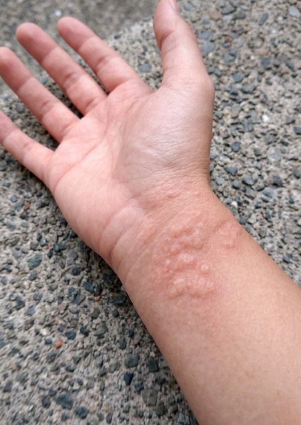 These are the consequences of sleeping with…