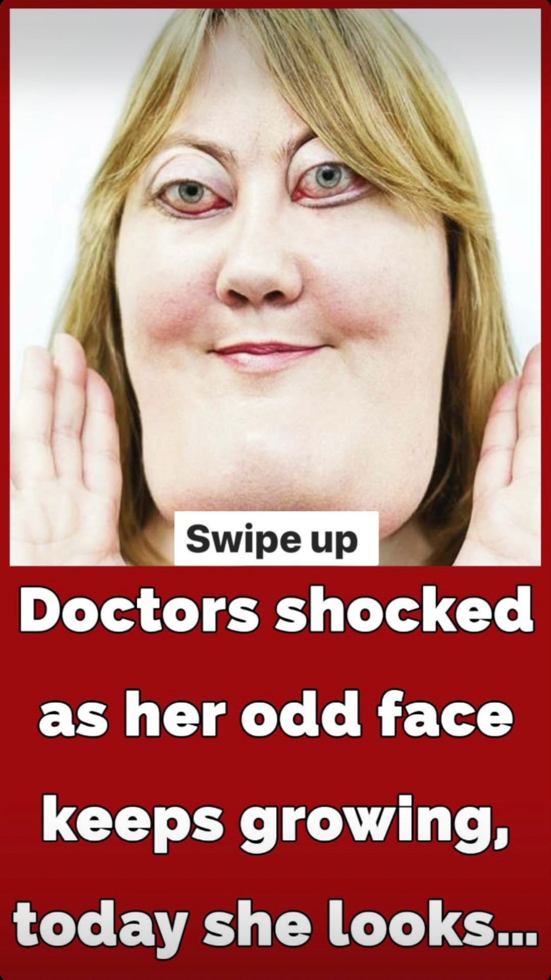 The incredible story of Victoria Wright: She inspires millions with her rare genetic condition