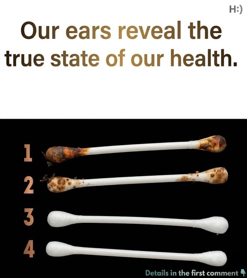 Our ears reveal our true state of health