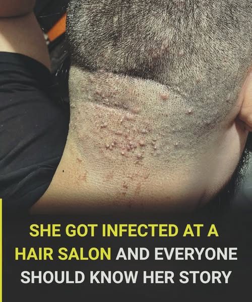 Haircut Health Warning: The Infection You Can Catch at the Salon and How to Stay Safe