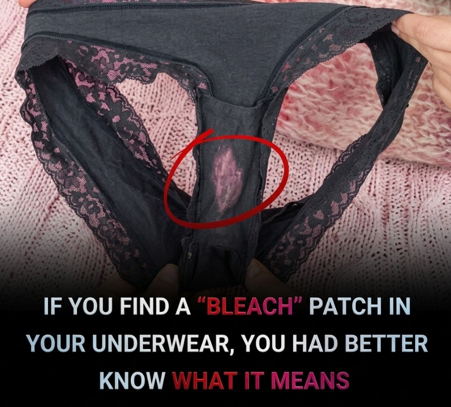 Why Bleach Like Stains On Underwear Are Normal Explained Through Vaginal Discharge Acidity And pH Balance Showing How Natural Body Processes Can Lighten Fabric Over Time While Indicating Healthy Function And When To Watch For Unusual Symptoms Like Odor Itching Or Discomfort For Proper Care And Awareness