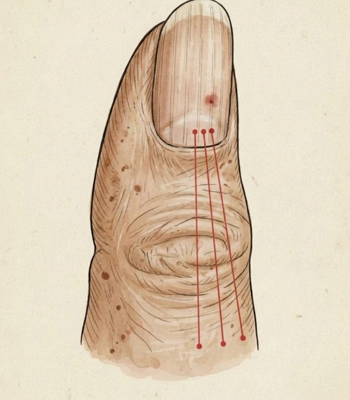 If You Have These Lines on Your Nails, You Should Pay Attention: Experts Explain That Changes in Nail Texture, Such as Ridges or Lines, Can Sometimes Reflect Normal Aging, Minor Injury, or Nutritional Factors, but Persistent or Sudden Changes May Also Signal Underlying Health Conditions—Highlighting the Importance of Monitoring Nail Health and Seeking Medical Advice if Unusual Signs Persist
