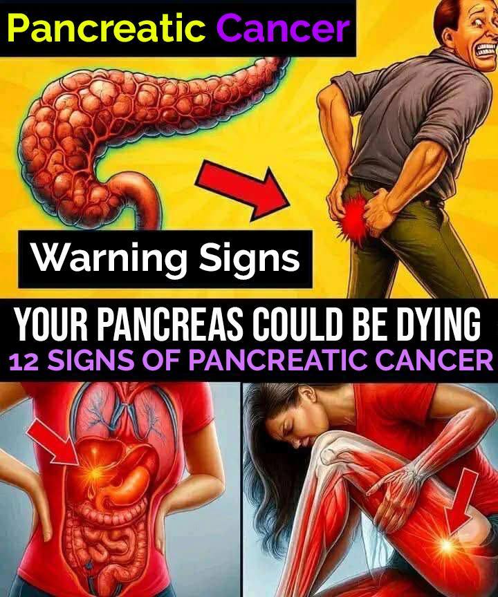 Signs of pancreatic cancer you should never ignore