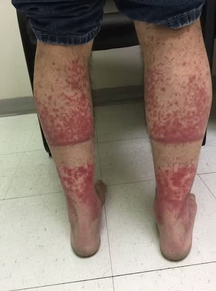 These are the consequences of sleeping with…See more