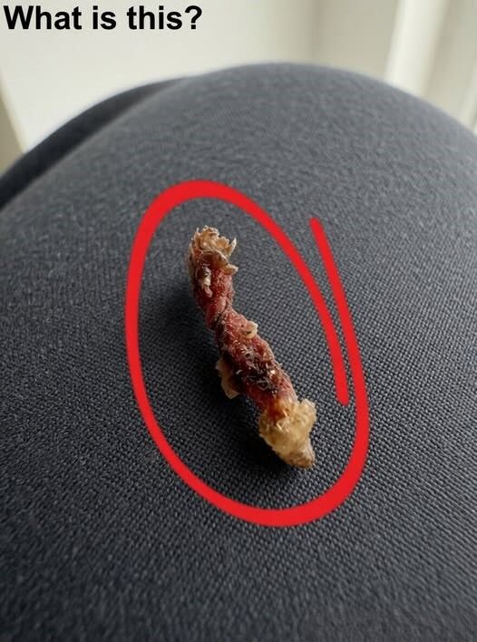 I Woke Up in the Middle of the Night Convinced Something Was Biting My Skin