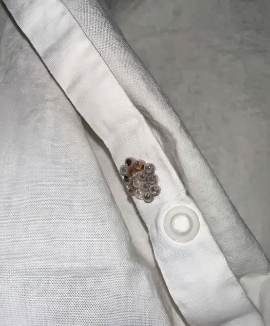 I found these tiny balls in my bed and nearly had a heart att.ack: here’s what they were