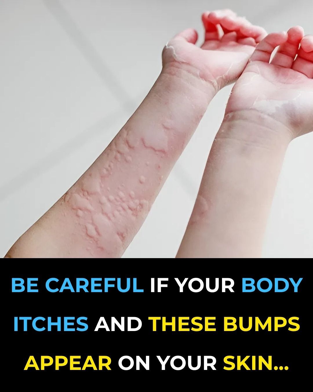 These are the consequences of sleeping with…