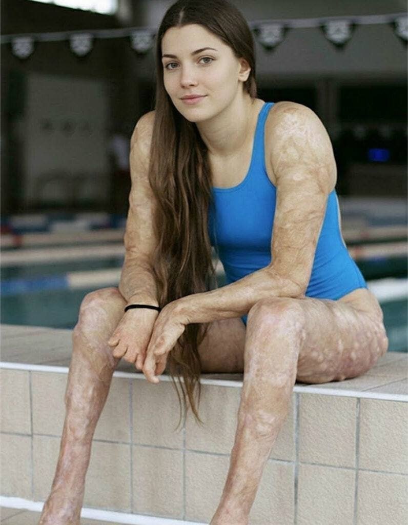 These are the consequences of sleeping co! See now