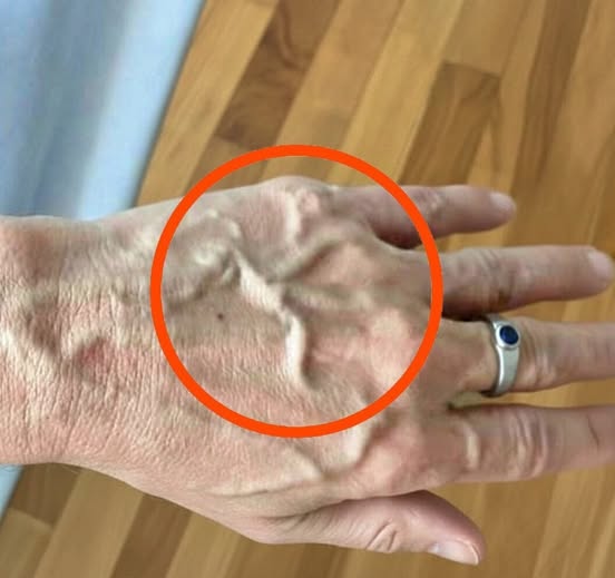 If you have visible veins, it means you are….