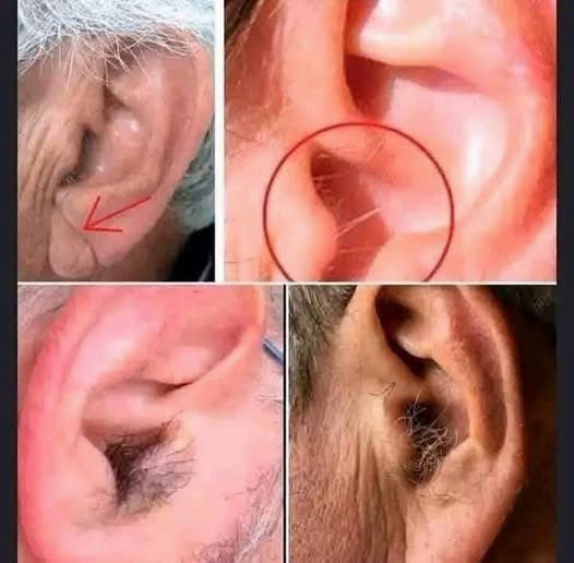 Did You Know That If Hair Grows On Your Ears It Is Not A Sign Of Illness Or Mystery But A Natural Result Of Aging Hormones Genetics And Time Working Quietly Inside The Human Body Over Many Decades