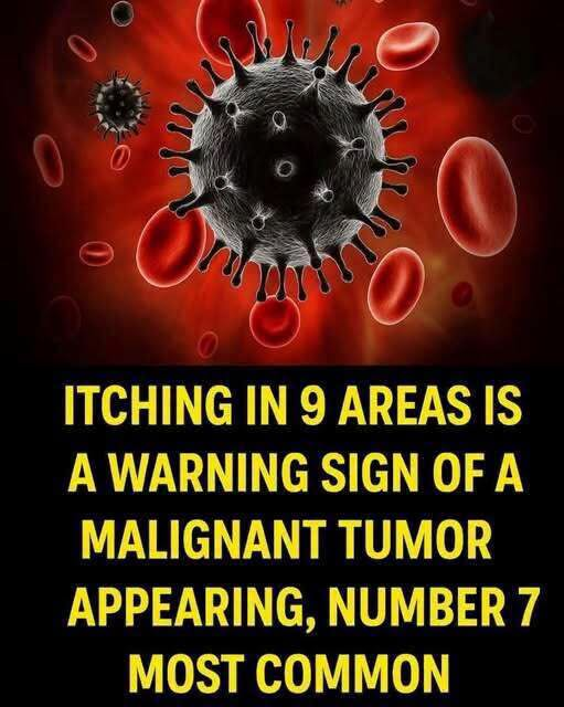 Itching in 9 Areas: A Warning Sign of Malignant Tumors, Number 7 Is the Most Common