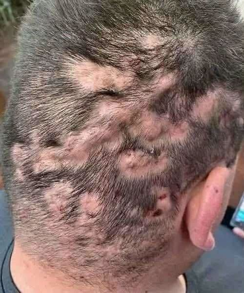 DO NOT IGNORE THE MARK, WHAT THOSE DARK PATCHES ON YOUR SKIN ARE REALLY TRYING TO TELL YOU