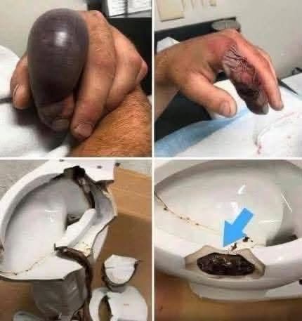 In several regions, while using their toilets, people were attacked by… see the 1st comment