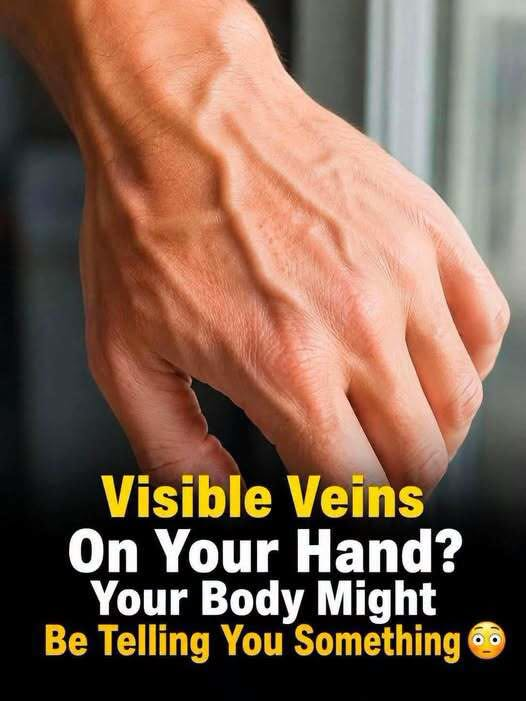 What Bulging Veins Can Mean