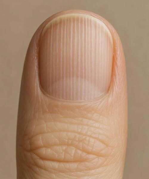Reading the Signs: A Practical Guide to Understanding Nail Lines