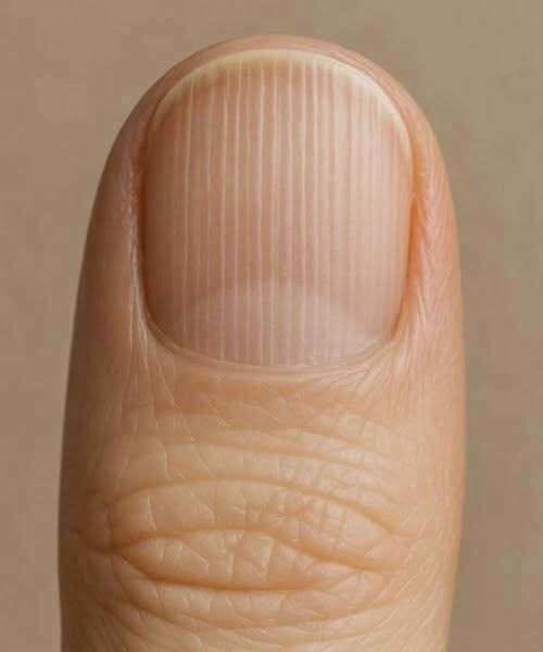 If you have these lines on your nails after 40, it is a clear sign that..