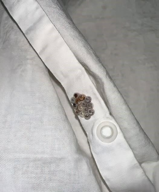 I found these tiny balls in my bed and nearly had a heart att.ack: here’s what they were