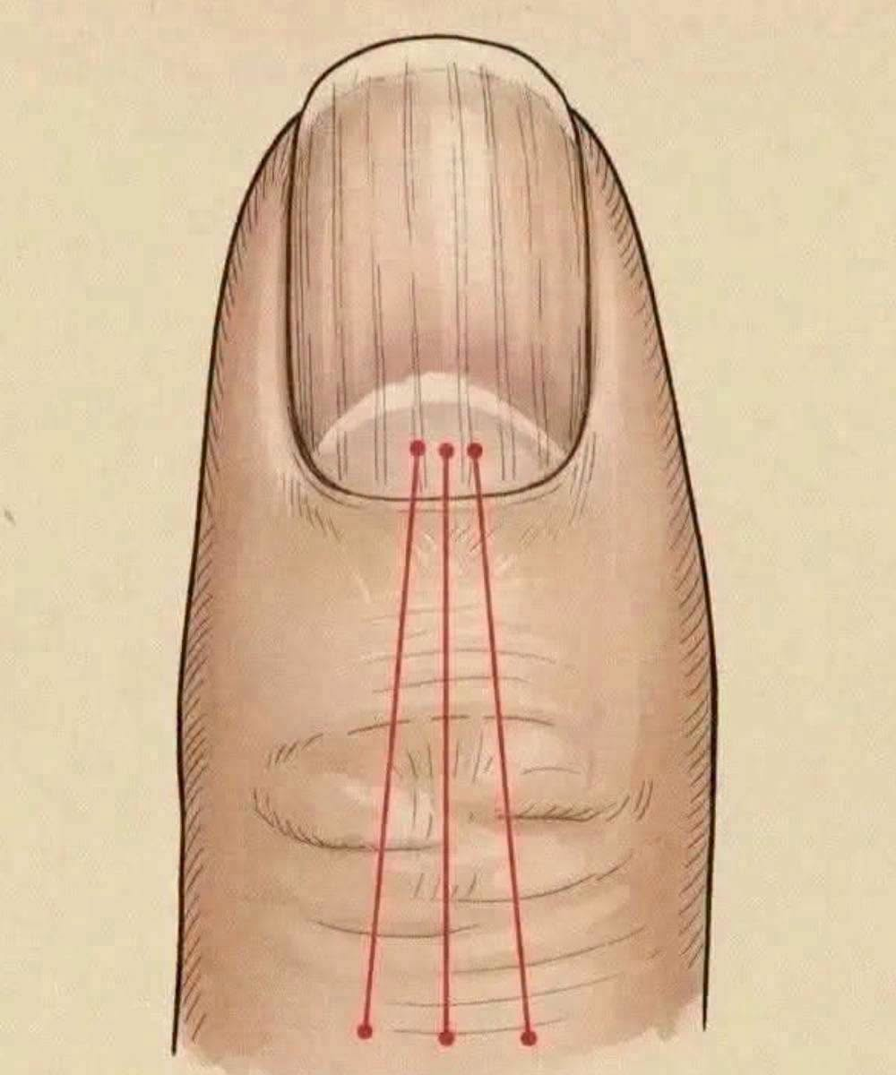 If you have these lines on your nails after 40, it is a clear sign that..