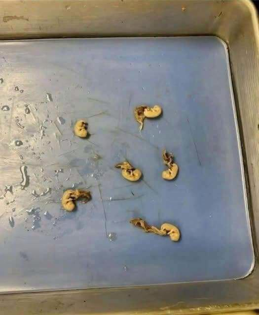 Hidden Seeds Food Warning