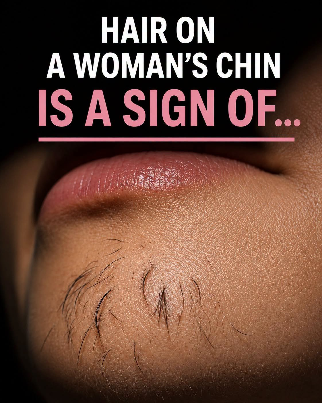 Why Chin Hair Grows in Women and What It May Indicate