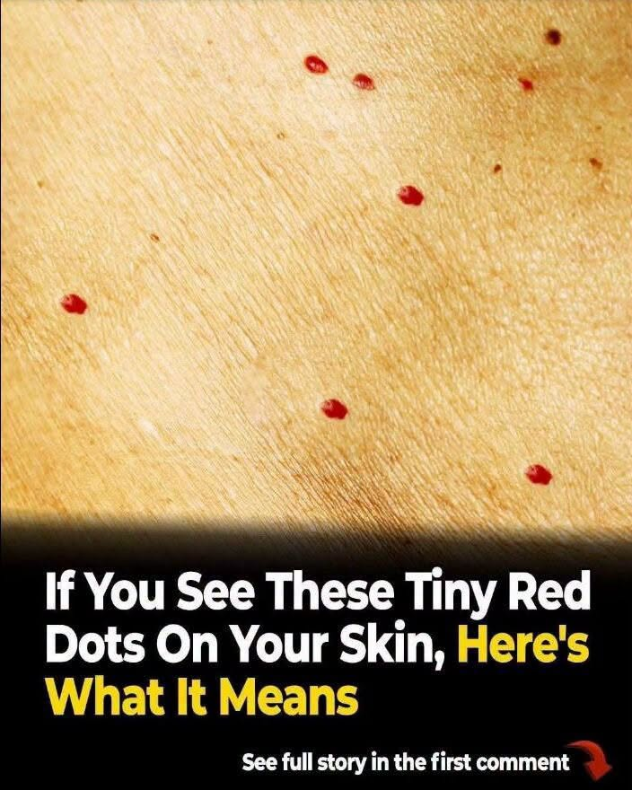 Red Dots on Your Skin: Causes and What They Could Mean…