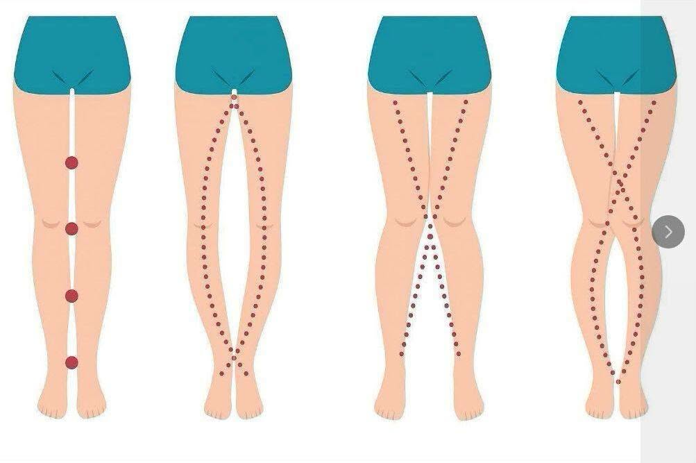 The Subtle Messages Hidden in a Woman’s Legs