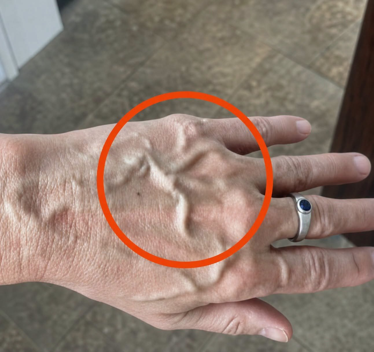 If you have visible veins, it means you are….