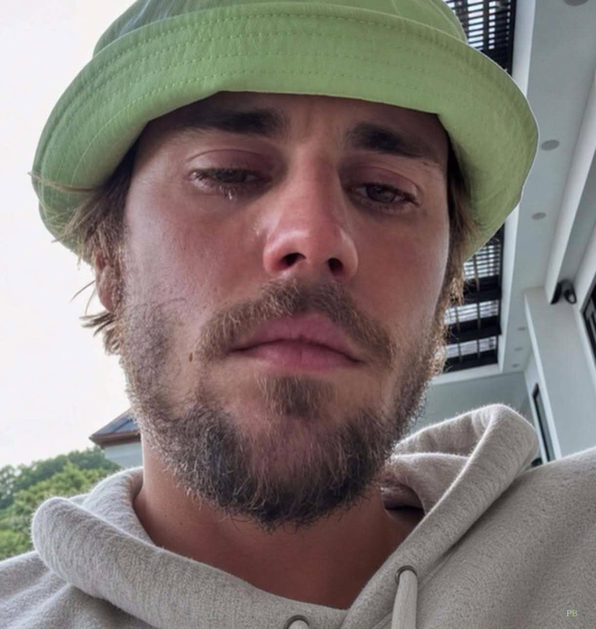 Justin Bieber admits that he tested positiv