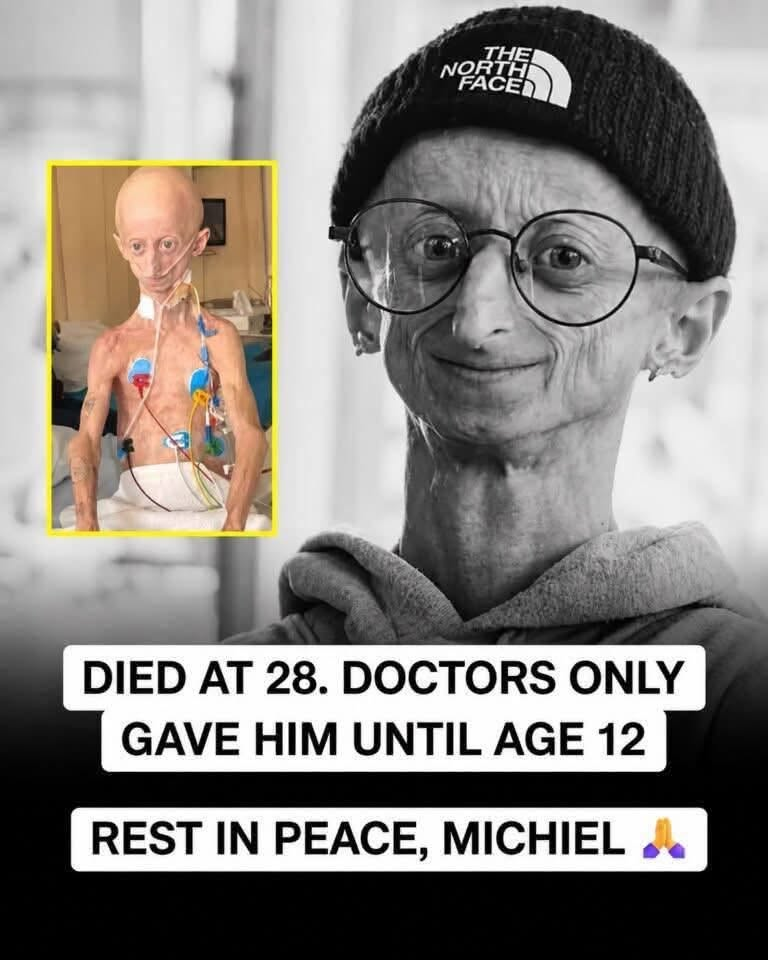 When Michiel Vandeweert was a child, doctors told his family that he would probably not make it to age 12.