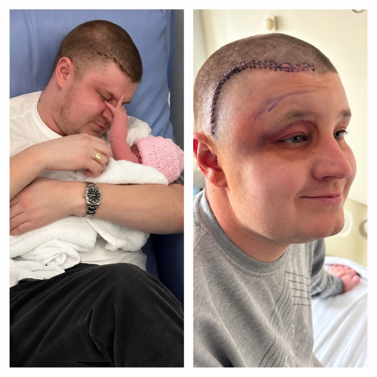 A Dad of Three Thought His Painful Migraines Were Nothing Serious—Then a Fall Changed Everything