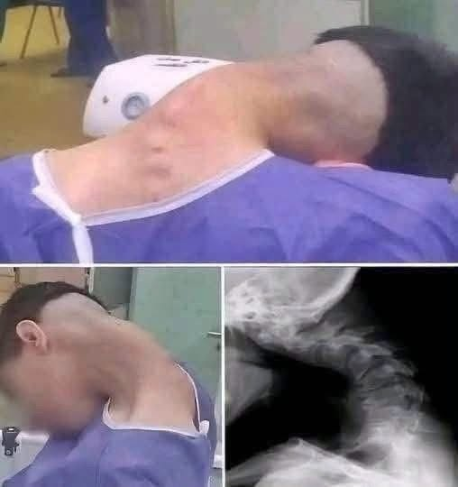 Young man hospitalized because he