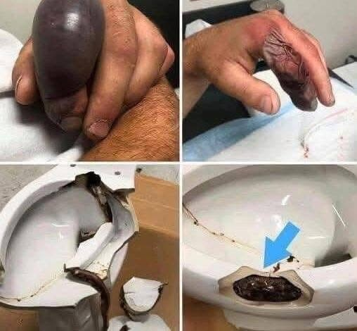 He went to the bathroom without knowing that there was a…See more