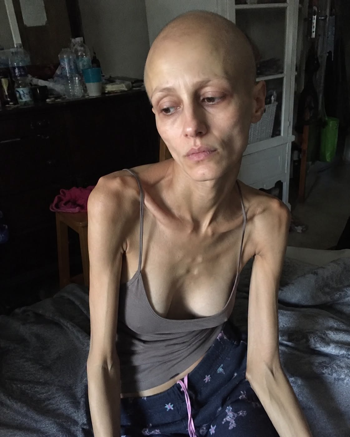 I Came Home Without Warning After Four Years in Canada and Found My Wife With a Shaved Head, Painfully Thin and Struggling Alone in the Backyard. My Mother Said She Had Brought This Punishment Upon Herself. I Didn’t Yell. I Reached for My Phone Instead…