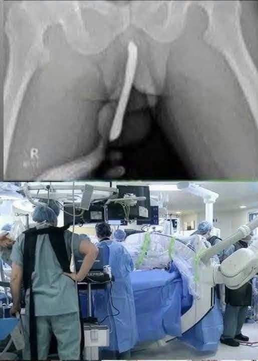 Girl Hospitalized After a Dangerous Trend
