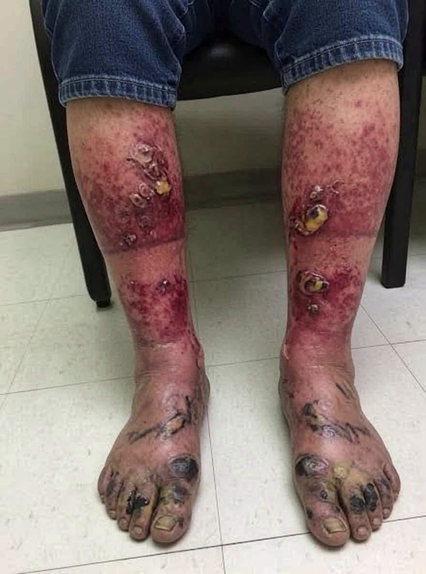 These are the consequences of sleeping with