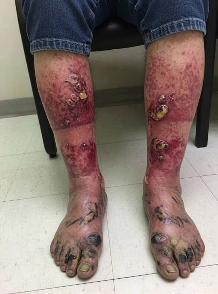 These are the consequences of sleeping with