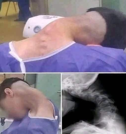 Young man hospitalized because he
