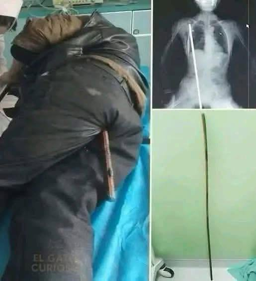 Young man hospitalized because he