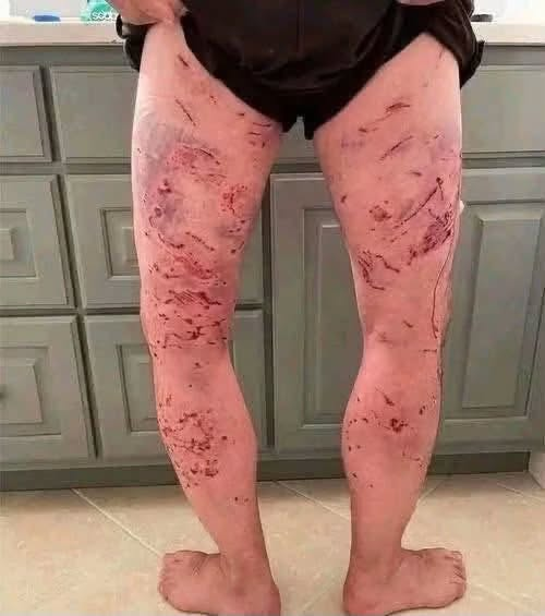 These are the consequences of sleeping with