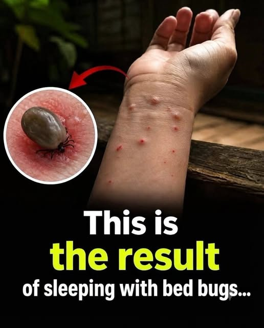 Bed Bugs Can Hide Where You Least Expect Them — Here Are the Clues Your Home May Be Sending You