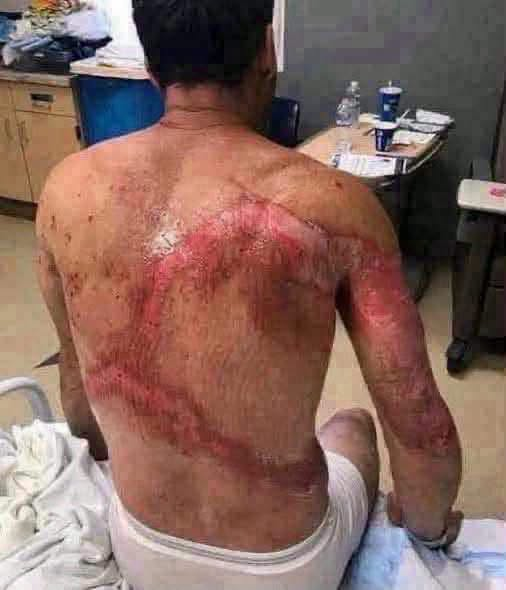 These are the consequences of sleeping with th